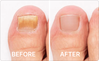 before - after